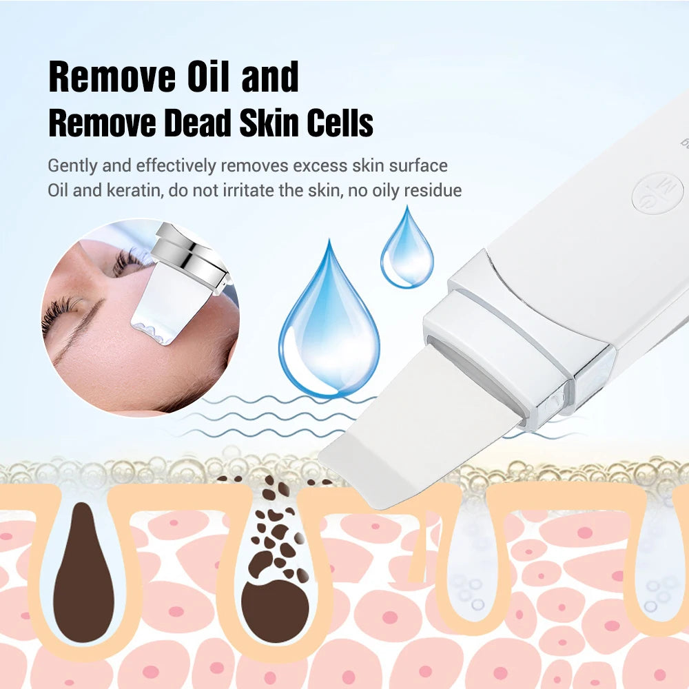 Ultrasonic Skin Scrubber Peeling Blackhead Remover Face Lifting Deep Face Cleaning Ion Ance Pore Cleaner Facial Shovel Cleaner